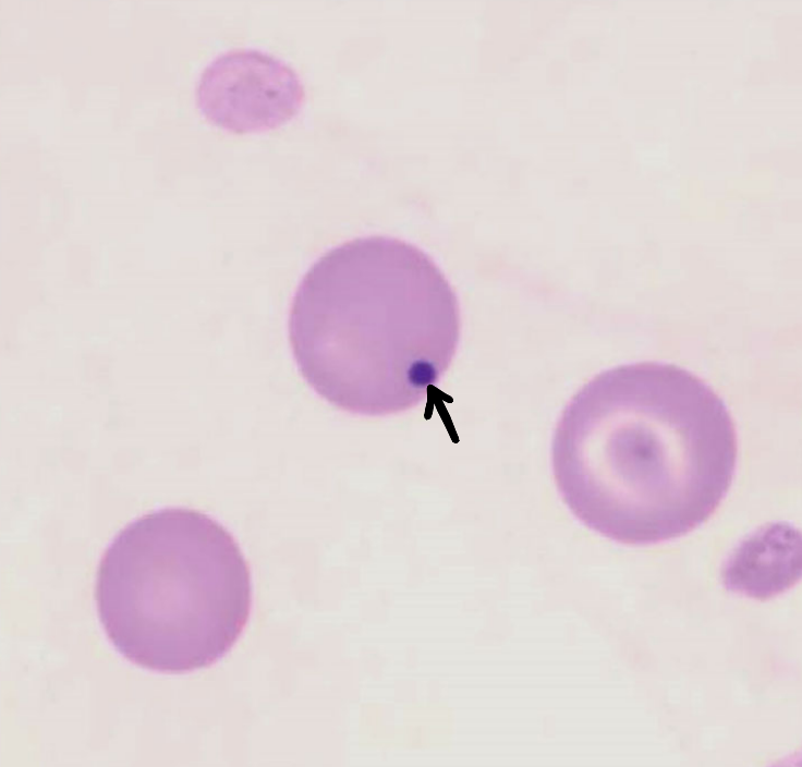 <ul><li><p>small, round, dark inclusion → <strong>nuclear remnant</strong></p></li><li><p>eventually removed by spleen (pitting function)</p><ul><li><p>more frequent in healthy cats due to poor splenic pitting function</p></li></ul></li><li><p>frequently seen in regenerative anemia</p></li><li><p>in the absence of regeneration, may be seen with diseases or absence of the spleen (post-splenectomy)</p></li></ul><p></p>