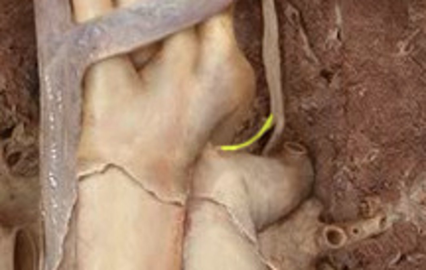 <p>SENSORY nerve to larynx BELOW to vocal cords</p>