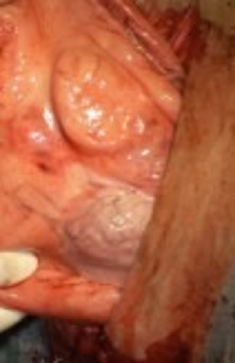 <p>identify the pylorus</p>