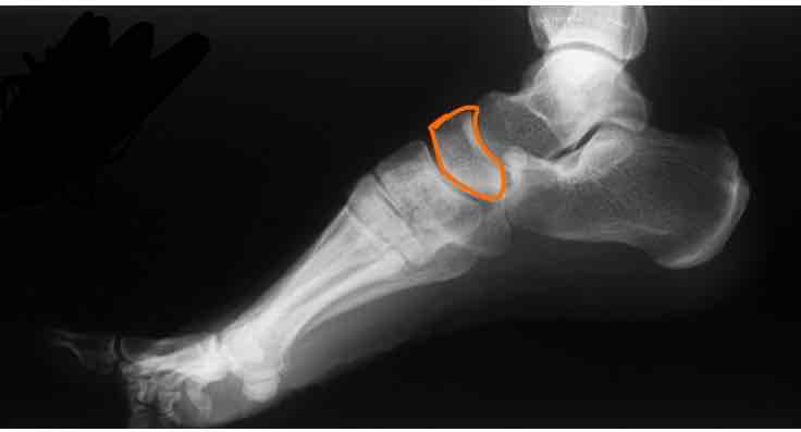 <p>What is this bone?</p>