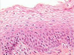 <p><strong>What is a picture example of stratified squamous epithelium tissue?</strong></p>