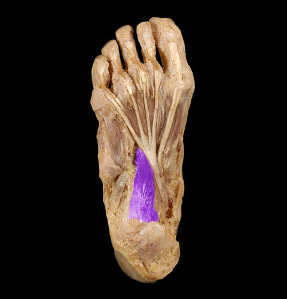 <p>Proximal attachment: Calcaneus</p><p>Distal attachment: Tendons of flexor digitorum longus</p><p>Comments, Applications and Relationships: Attaches to the tendons of the flexor digitorum longus</p><p>Action: Flexes digits 2-5</p>