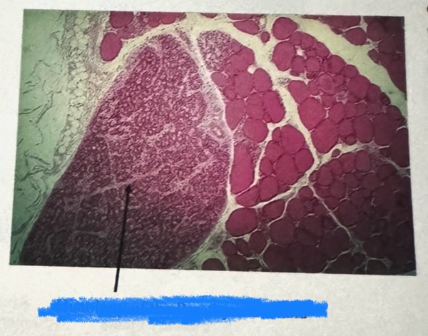 <p>What is this an image of?</p>