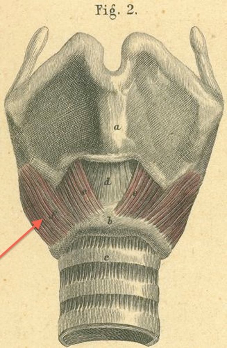<p>Name the Muscle</p>