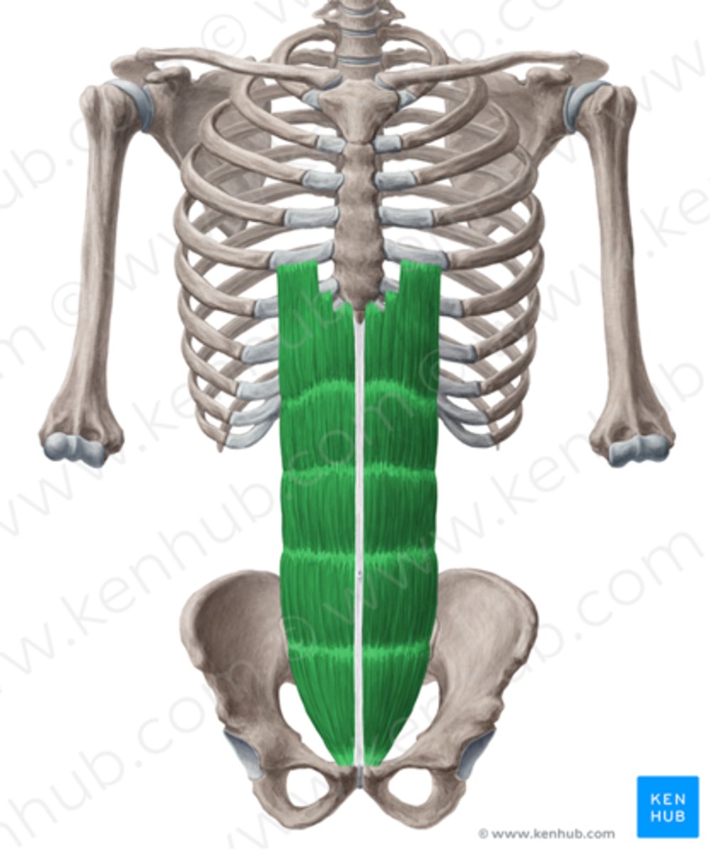 <p>Welke spier is dit?</p>