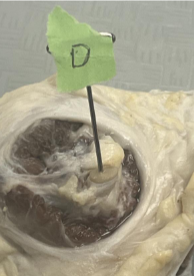 <p>What does Label D represent?</p>