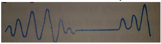 <p>Cheynes-Stokes</p>