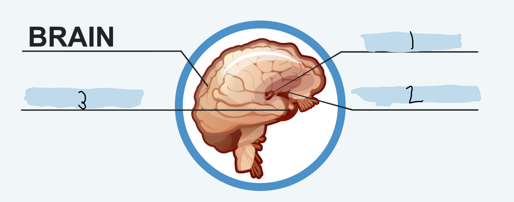 <p>Label the image</p>