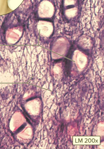 <p>What type of cartilage?</p>