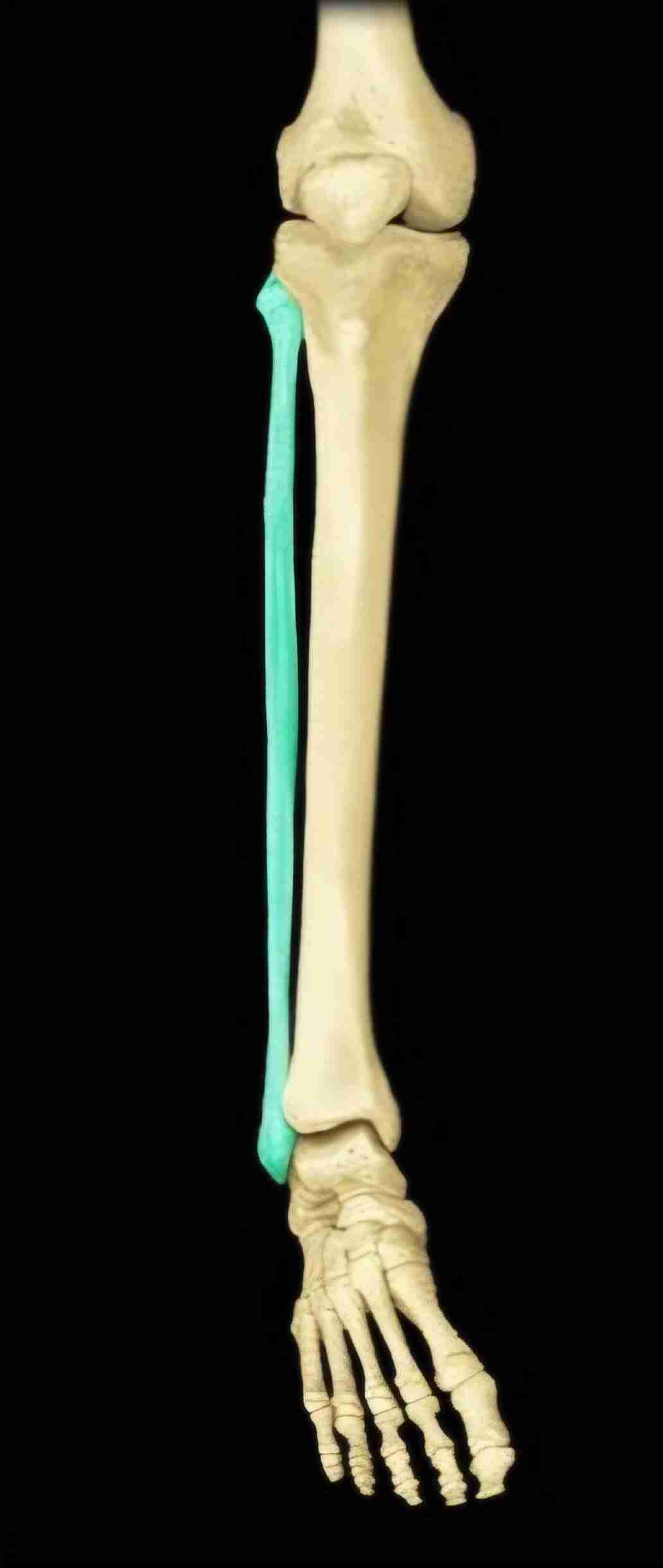 <p>What bone is this?</p>