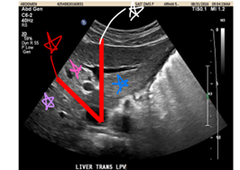 <p>Identify the outlined structures</p>