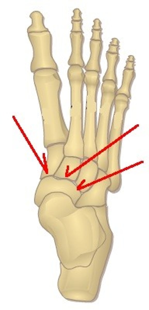 <p>Uniaxial- Allows bones to glide past each other along the plane of the joint (e.g. Joints between tarsal bones in the foot)</p>