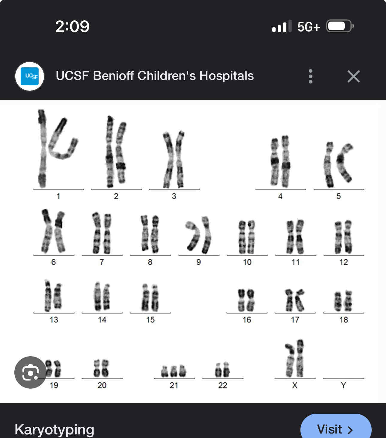 <p> Are pictures of chromosomes that has been arranged according to number, size, shape or other characteristics </p>