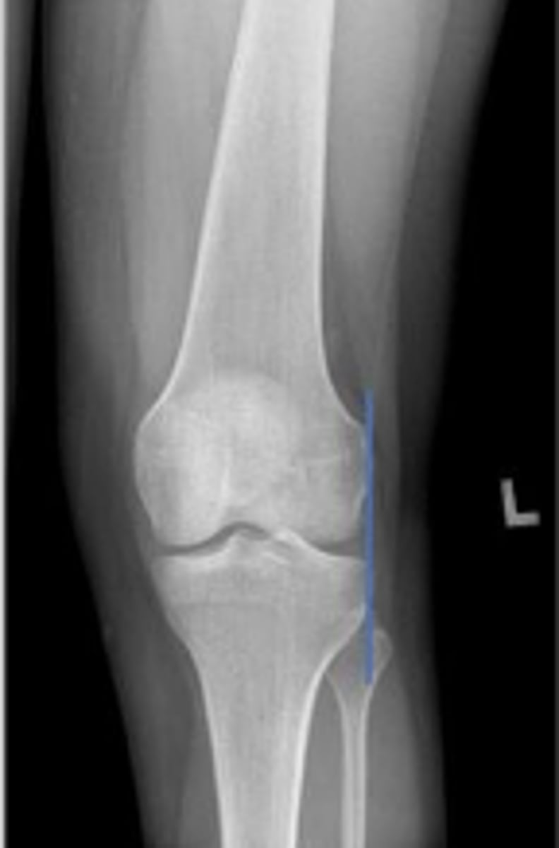 <p>What is the assessment?</p>