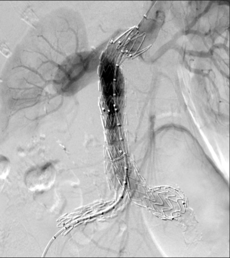 <p>identify the interventional procedure</p>