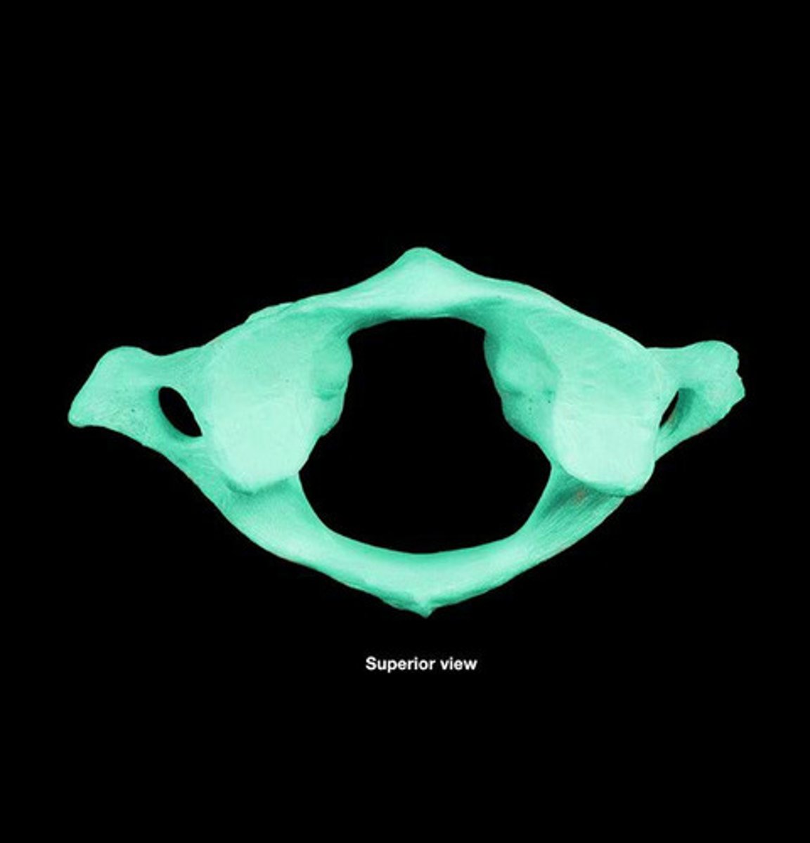 <p>The First Vertebrae found in the Cervical Vertebrae. (C1) Is the bone which the skull rests on. Is the only disk without a body. (Latin for the Titan god which holds up the world.)</p>