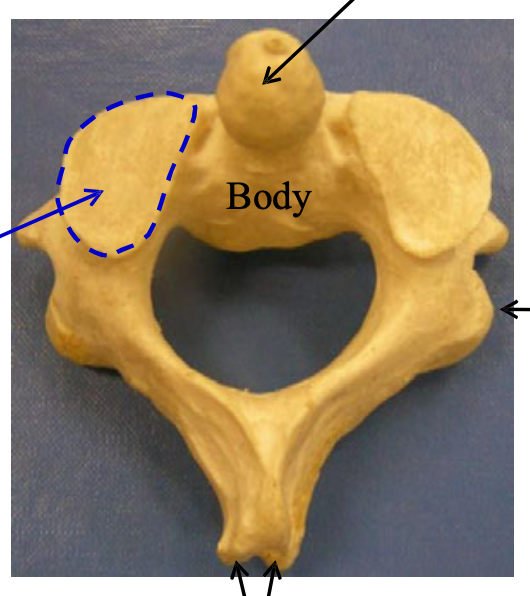 <p>Name the vertebra.</p>
