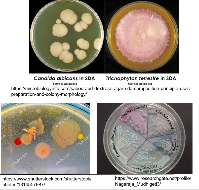 <p>What <strong>media </strong>are used in<strong> fungal culture?</strong></p>
