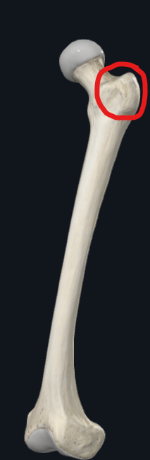 <p>What is this part of the femur called?</p>