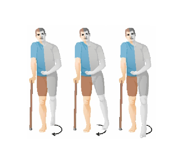 Was ist dies für eine Gangstörung? und was ist die Erklärung und die Krankheitsbilder?