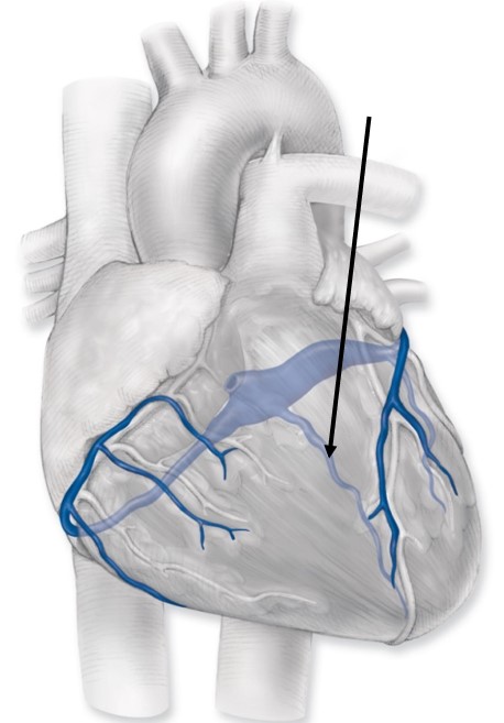 <p>Identify the vessel lying under the tip of the arrow (Hint:&nbsp;It is draining&nbsp;relatively deoxygenated blood from the tissue in this area.)</p>