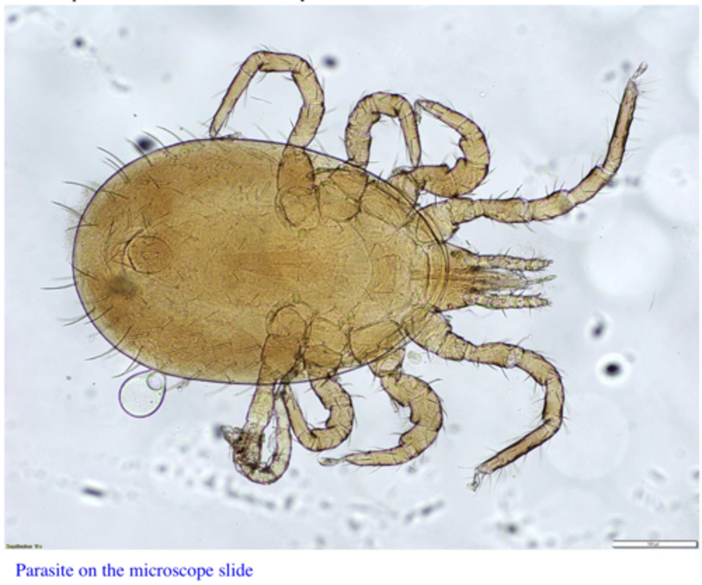 <p>Station 11:</p><p>Anemia, loss of condition, fall in egg production and irritation were noticed in birds grownunder traditional conditions in a small farm araound Townsville. The parasites on the microscope slide were found on the body of the birds.</p>