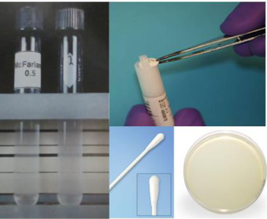 <p>What is the streaking used in this test?</p>