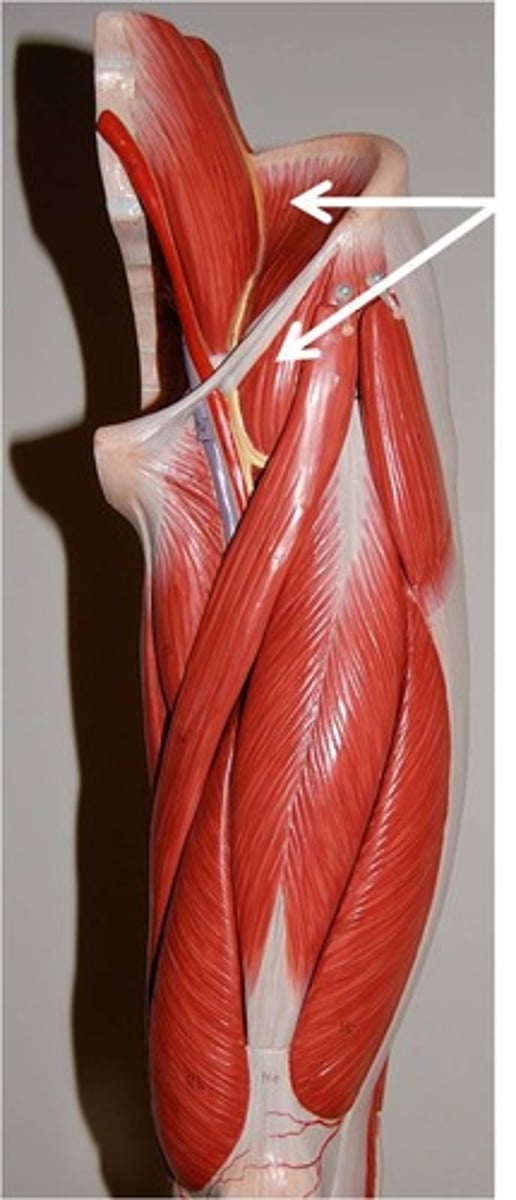 <p>Origin: Iliac fossa, sacrum</p><p>Insertion: Psoas major tendon, lesser trochanter of femur </p><p>Action: Hip flexion </p>