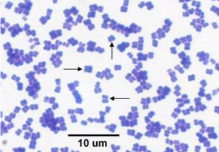 <p>What bacteria is this?</p>