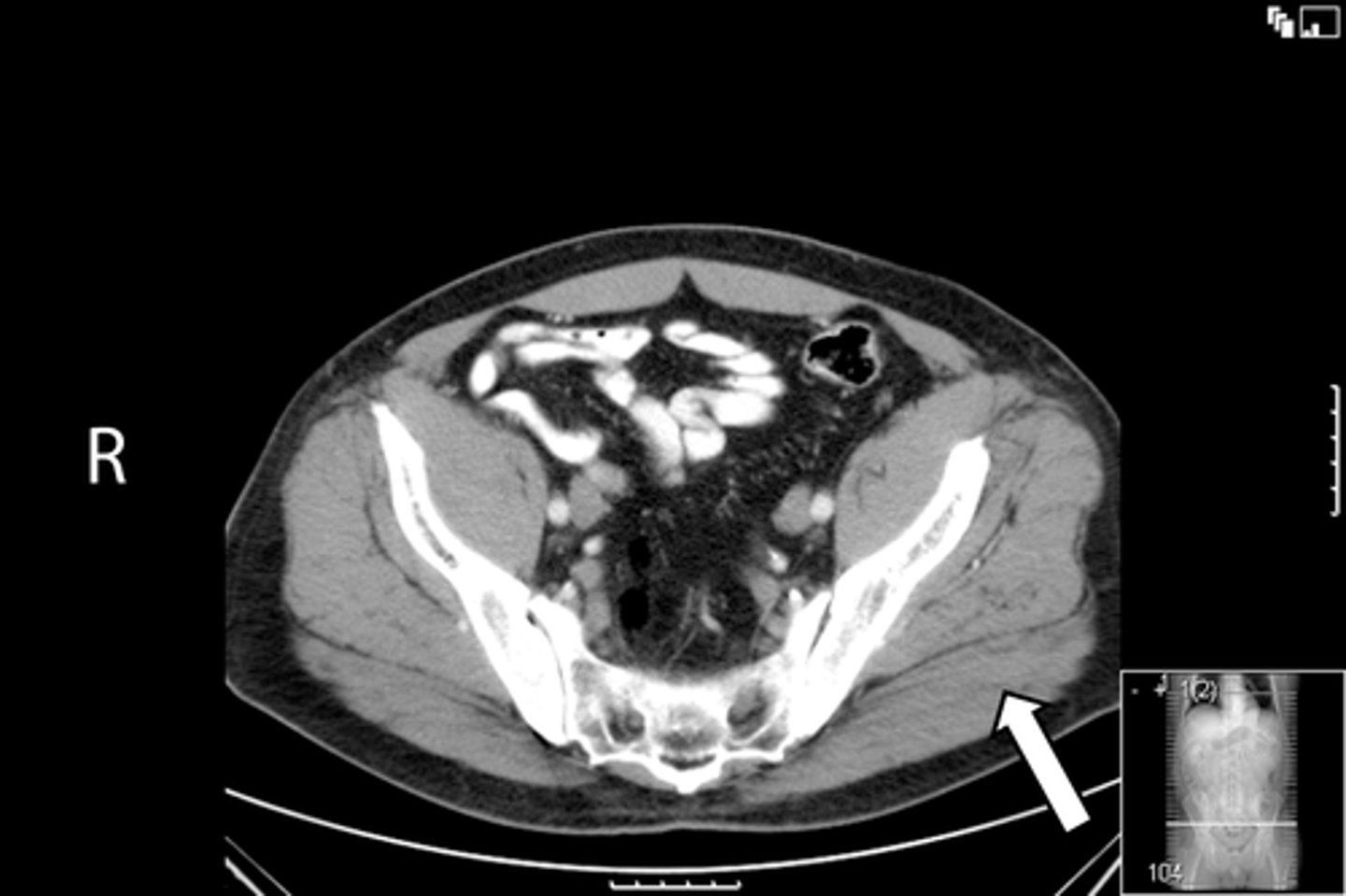 <p>What is indicated in the image?</p>