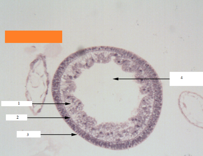 <p>Phylum?Class?<br>Symmetry? Tissue type? <br><br>1/2/3/4?</p>