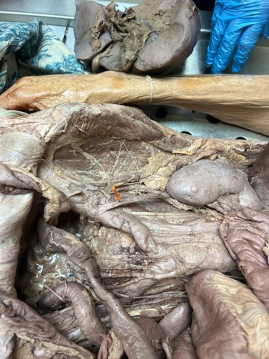 <p>ureter</p>