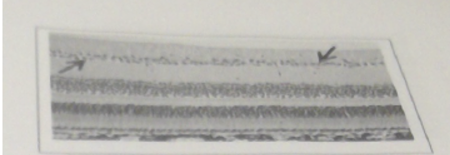 31\. The layer indicated by the arrows
