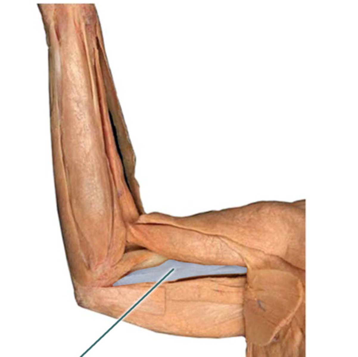 <p>What muscle is this?</p><p>Origin?</p><p>Insertion?</p><p>Action?</p><p>Nerve?</p>