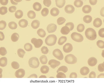 <p>what is a leptocyte?</p>