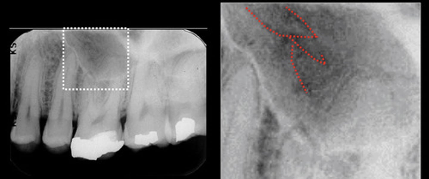 <p>What are the red dotted lines representing?</p>