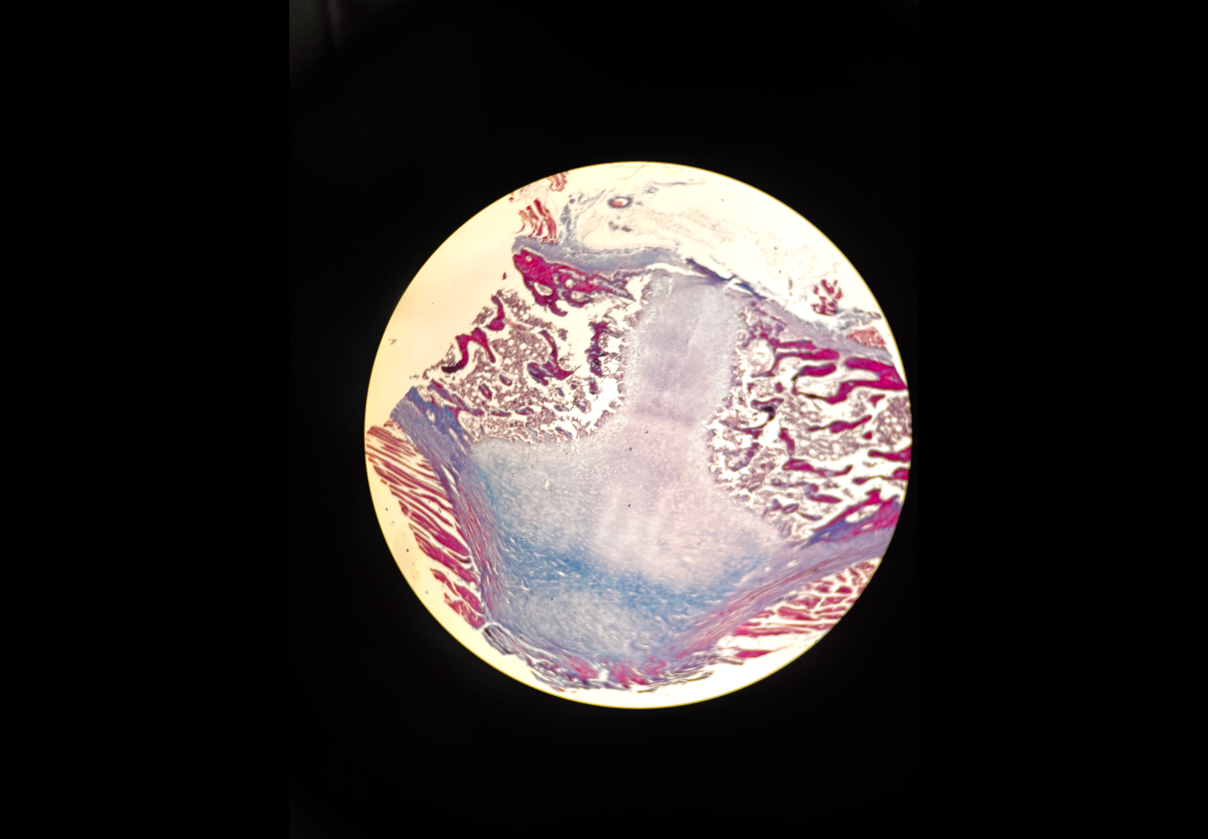 <p>Body location: pubic symphysis</p>