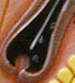 <p>Hair Root</p>