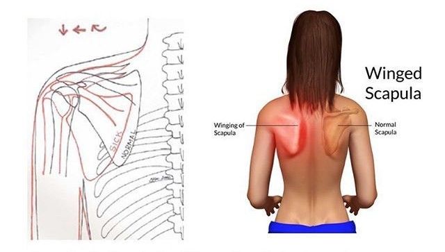 <p>Shoulder Blade</p>