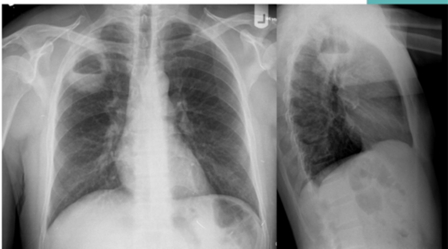 <p>Name the condition</p>