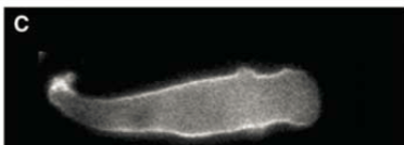 <p>inhibitor of PIP3, so it inhibits the localization of PIP3 at the sides of the cell; localizes everywhere except the front of the cell</p>