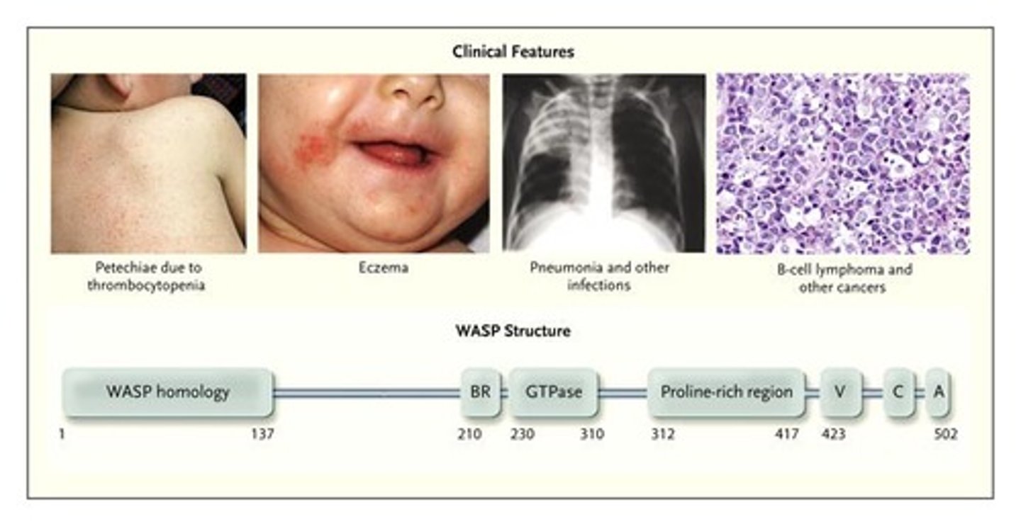 <p>upper resp infections, IBD, allergies</p>