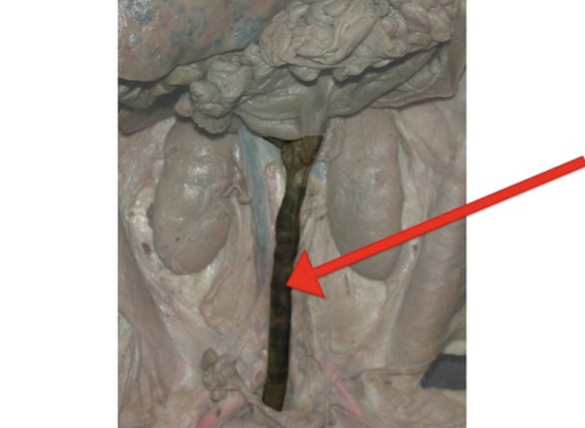 <p>Terminal part of the large intestine where feces are stored before elimination.</p>