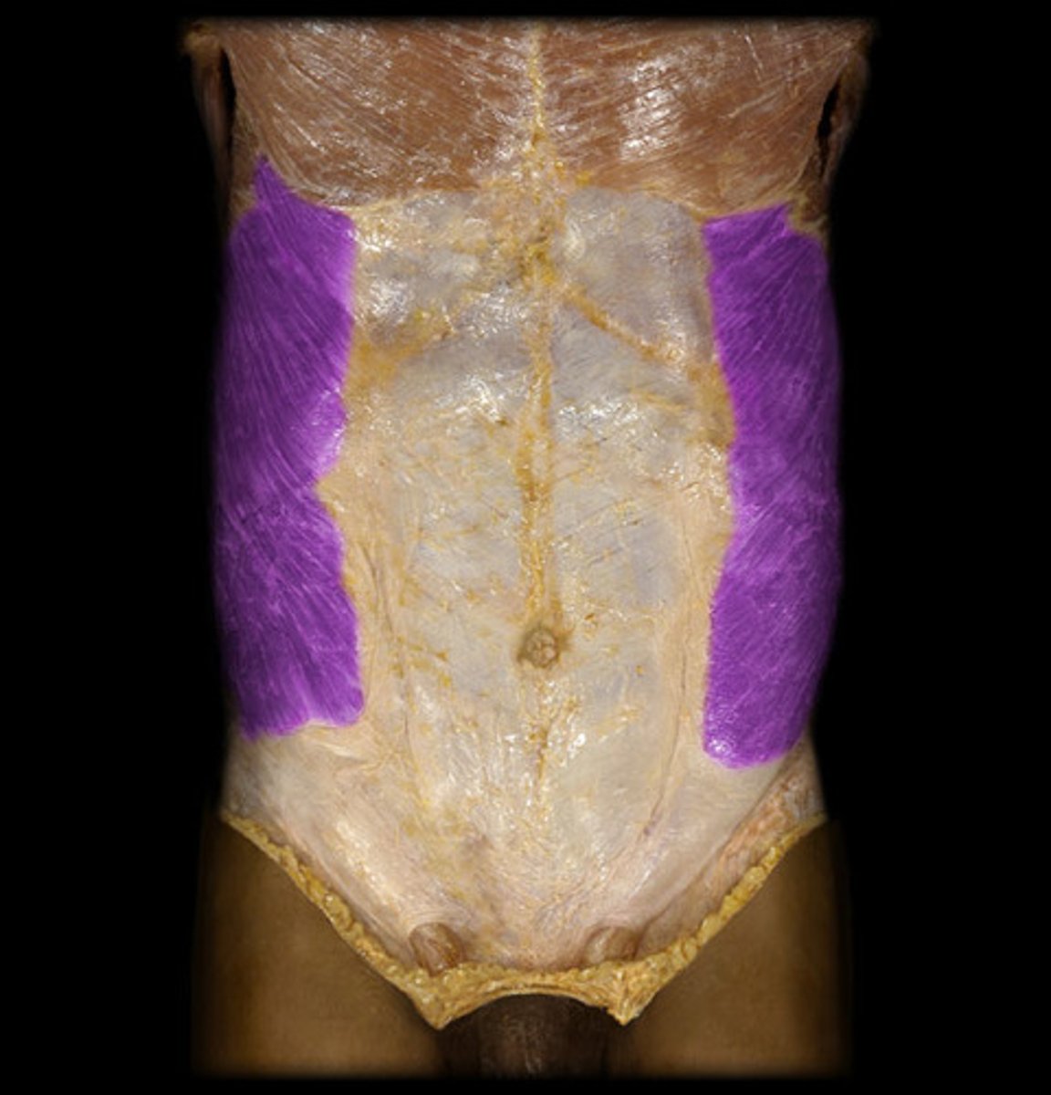 <p>Origin: Ribs 5-12; Insertion: Linea alba and iliac crest</p>