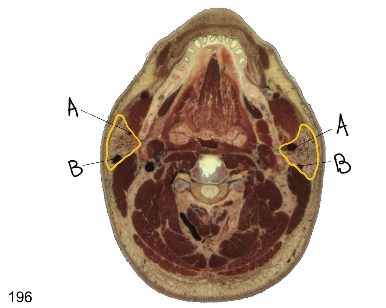 <p>what structure is labeled B?</p>