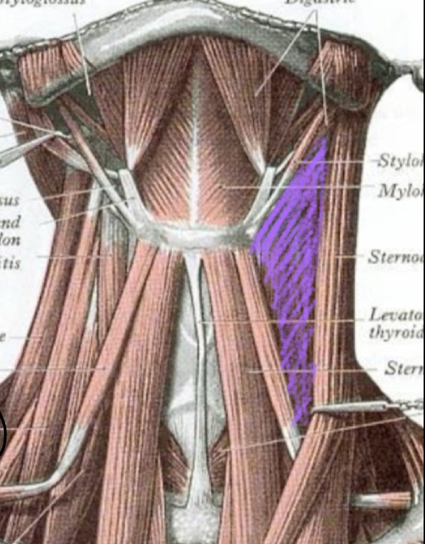 <p>Carotid Triangle - Boundaries</p>