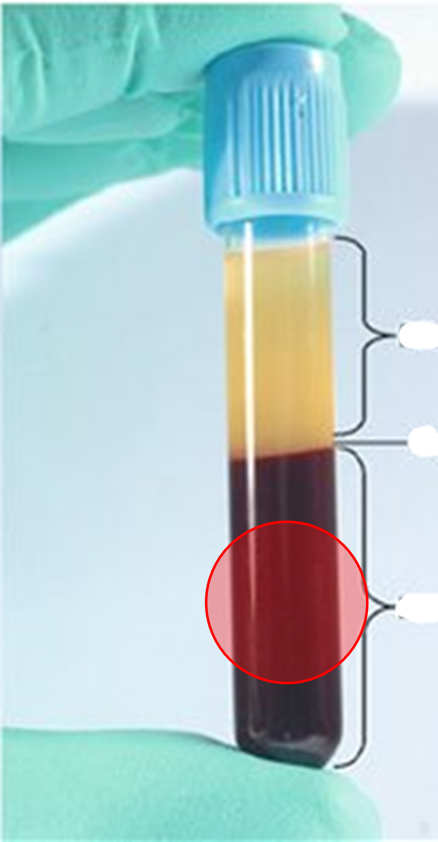 • The bottom layer of centrifuged blood.

• Consists of erythrocytes.