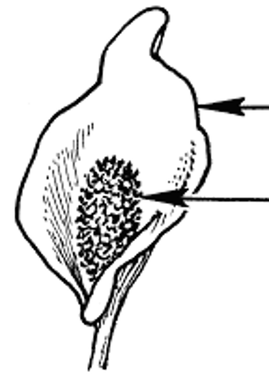<p>what is the bottom arrow pointing to?</p>
