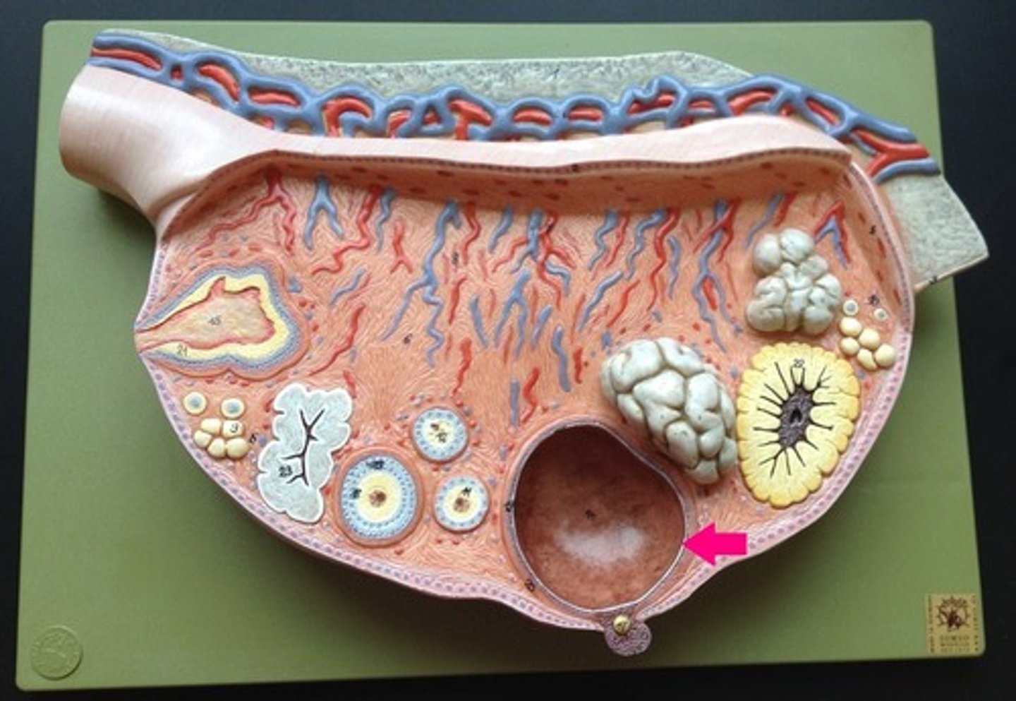 <p>the mature follicle that ruptures once a month (ovulation)</p>