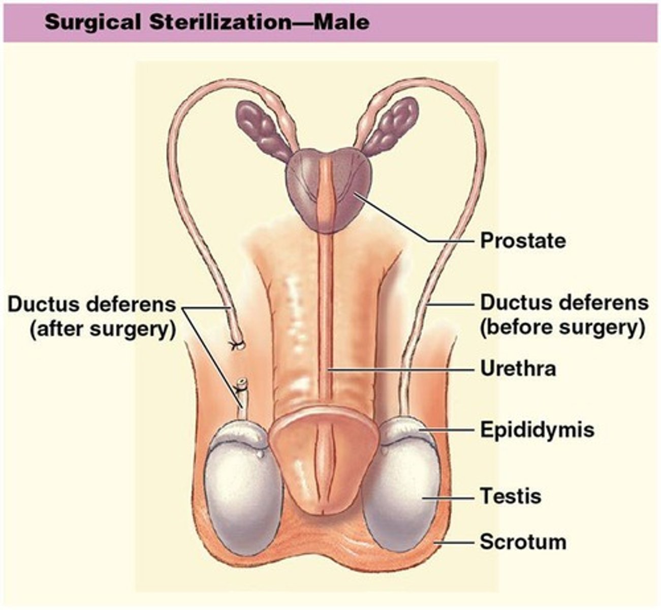 <p>40-45 cm (16-18 in.) long, passes through spermatic cord, transports sperm from the epididymis</p>